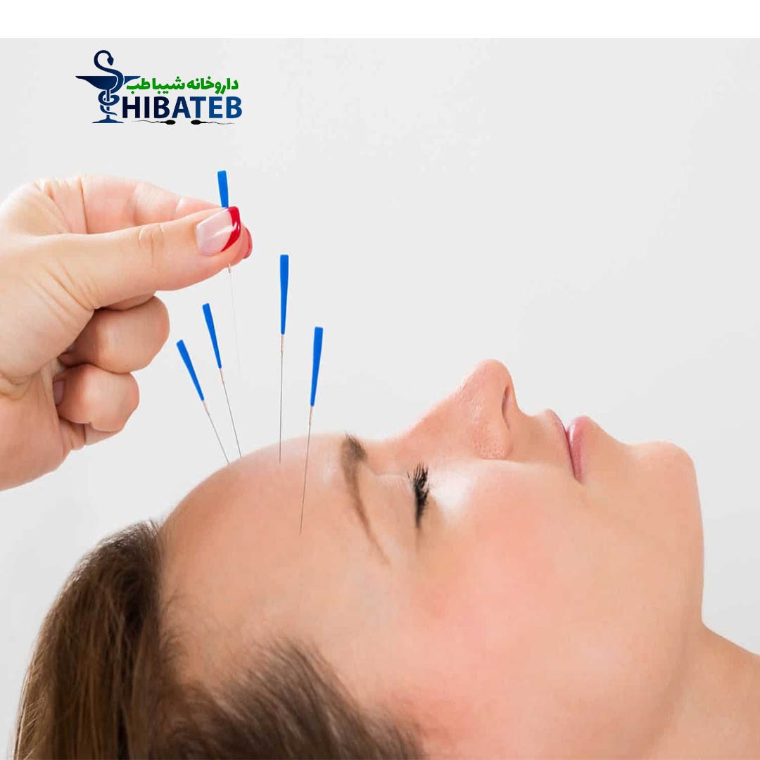 معرفی طب سوزنی و کاربرد آن در درمان بیماری ها