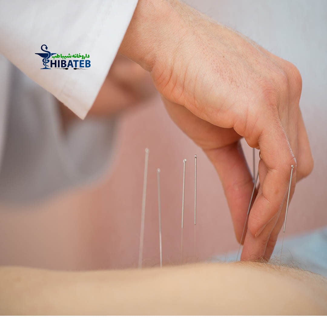 کیا از طب سوزنی نتیجه گرفتن